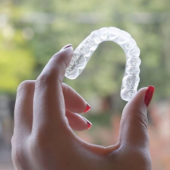 Sorriso alinhado: Oito fatos sobre o uso de alinhadores transparentes