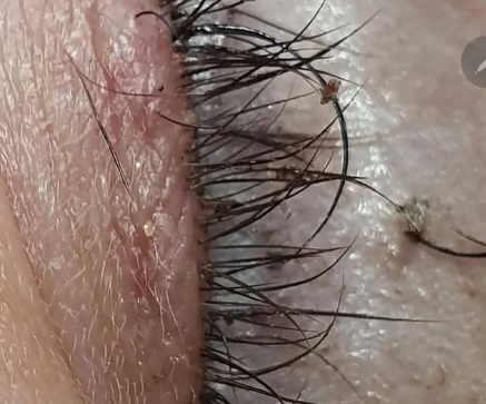 Verão: cuidados com a extensão de cílios devem ser dobrados nesta estação do ano Beleza