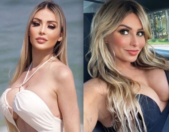 Modelo morre após complicações com silicone industrial; conheça os riscos fatais do PMMA Moda