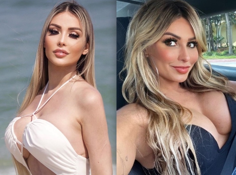 Modelo morre após complicações com silicone industrial; conheça os riscos fatais do PMMA Beleza