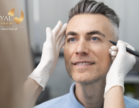 Clínica de beleza Royal Face inaugura mais uma unidade em Taguatinga empreendedores