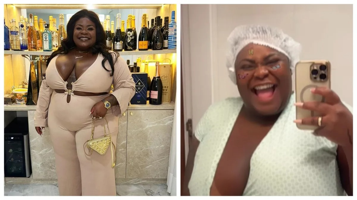 Cirurgia Bariátrica: Saiba Tudo Sobre a Recuperação e as Reparações Necessárias para a Cirurgia que Jojo Todynho Fez Celebridades