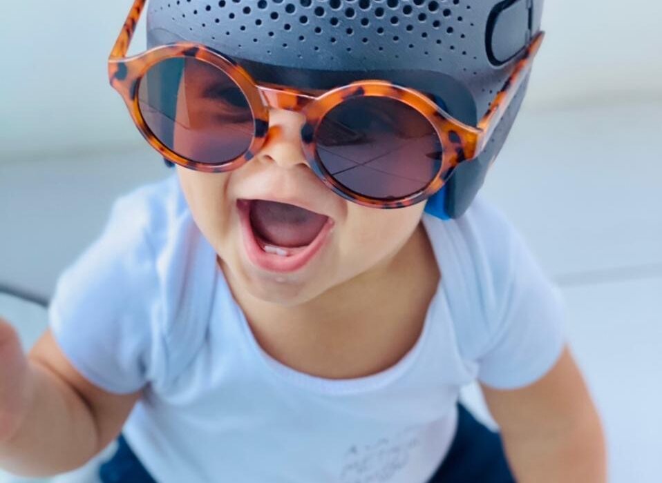 Filho da Paris Hilton: afinal qual o formato considerado normal da cabeça do bebê? Saúde