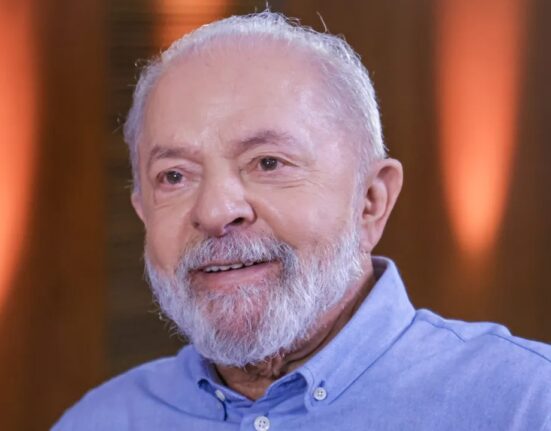 Saiba Tudo Sobre a Cirurgia Plástica que o Presidente Lula Fez nas Pálpebras Cultura