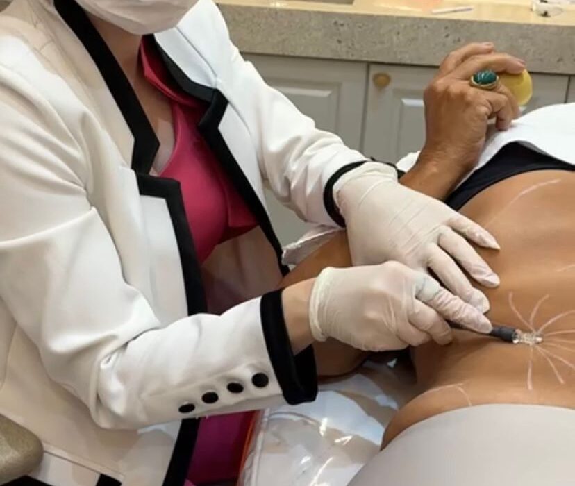 Harmonização facial e corporal ganham técnica exclusiva que garante maior segurança e promove uma medicina regenerativa Beleza