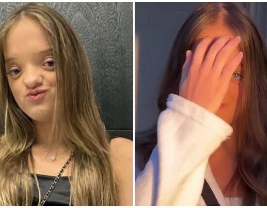 Rinoplastia na adolescência: entenda as considerações e desafios da cirurgia em Jovens Geral