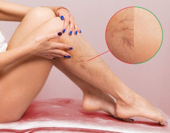 Flebite: entenda a doença, seus sintomas e formas de prevenção Gastronomia