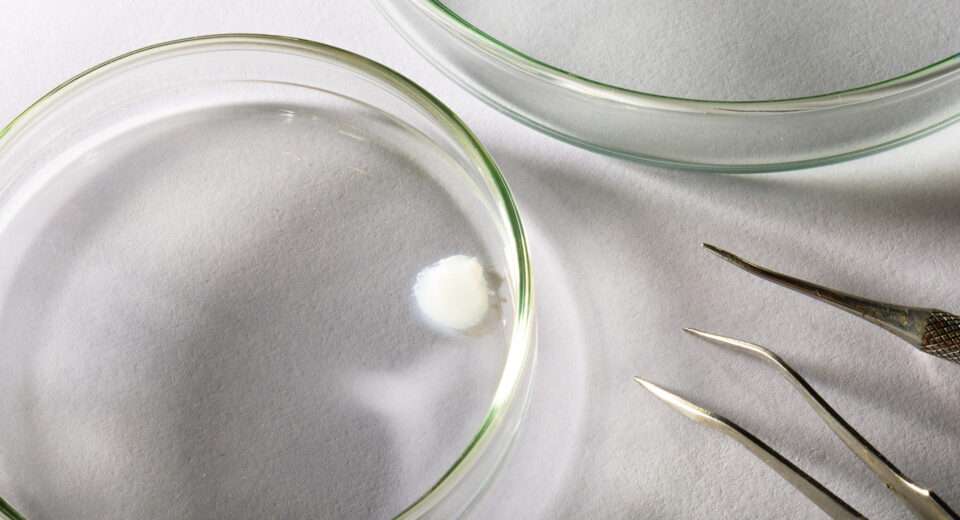 Avon desenvolve primeira pele bioimpressa em laboratório que reproduz efeitos da menopausar Beleza